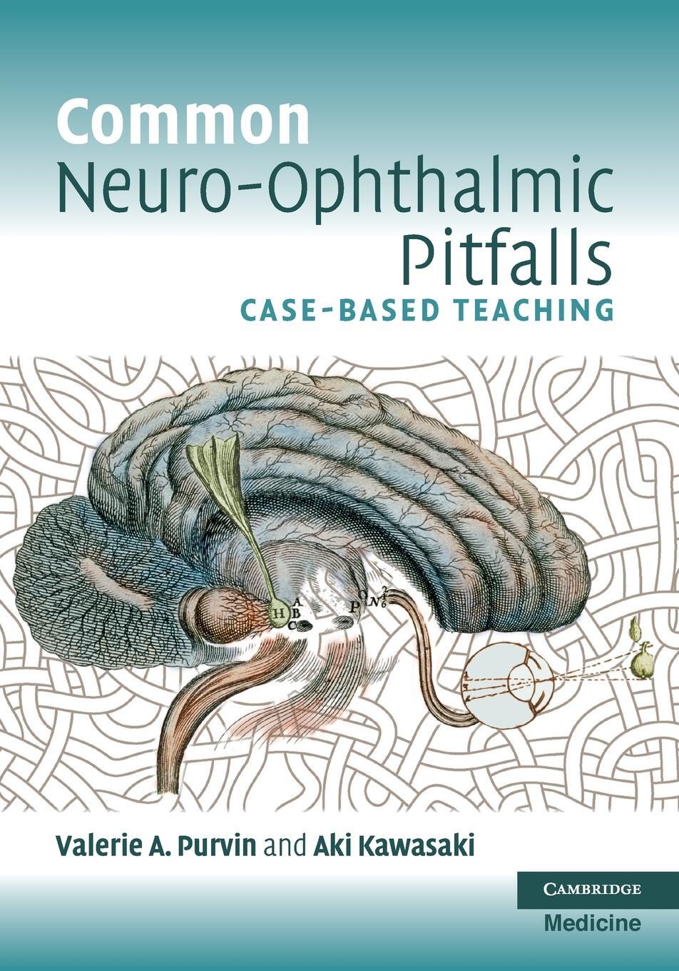 Cover: 9780521713269 | Common Neuro-Ophthalmic Pitfalls | Case-Based Teaching | Taschenbuch