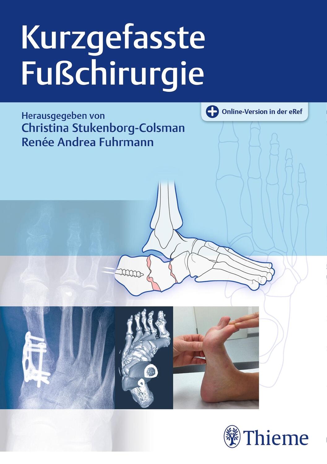 Cover: 9783132010215 | Kurzgefasste Fußchirurgie | Christina Stukenborg-Colsman (u. a.)