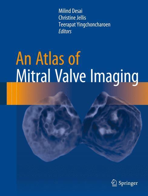 Cover: 9781447166719 | An Atlas of Mitral Valve Imaging | Milind Desai (u. a.) | Buch | xxvii