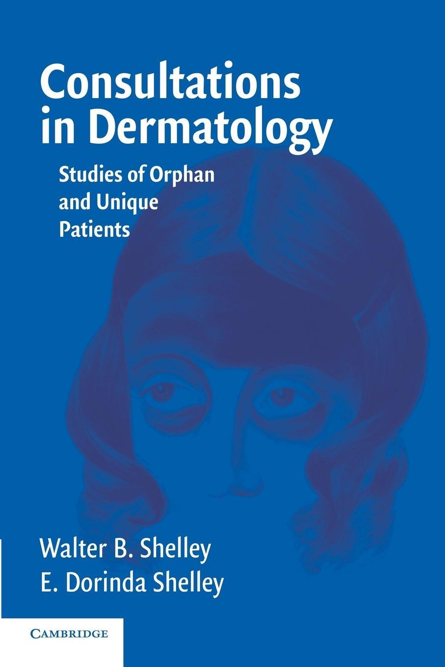 Cover: 9780521616584 | Consultations in Dermatology | Studies of Orphan and Unique Patients