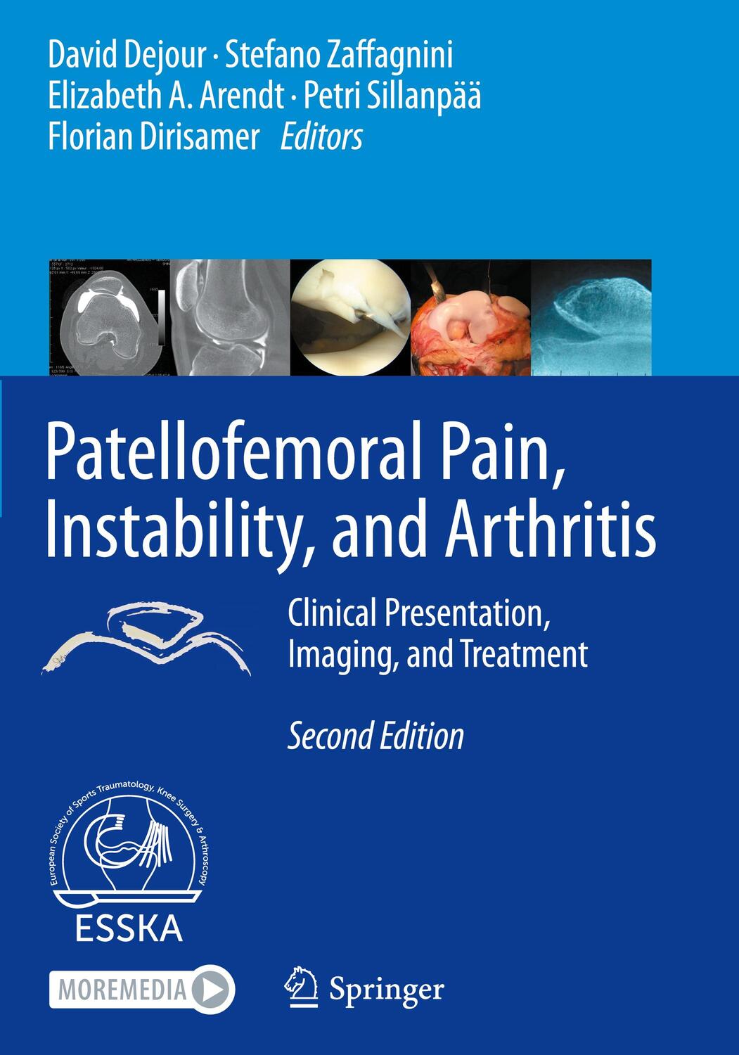 Cover: 9783662610961 | Patellofemoral Pain, Instability, and Arthritis | David Dejour (u. a.)