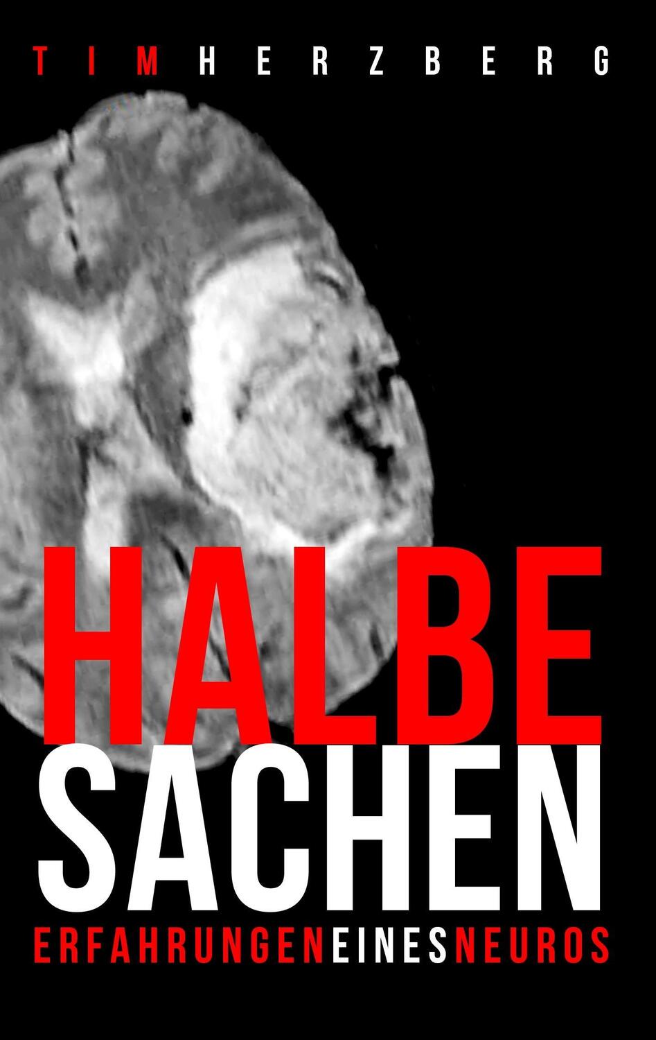 Cover: 9783732236077 | Halbe Sachen! | Erfahrungen eines Neuros | Tim Herzberg | Taschenbuch
