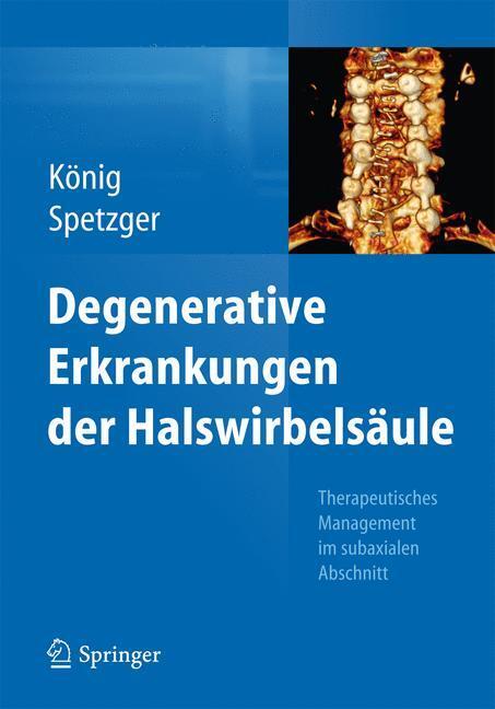 Cover: 9783662435618 | Degenerative Erkrankungen der Halswirbelsäule | Uwe Spetzger (u. a.)