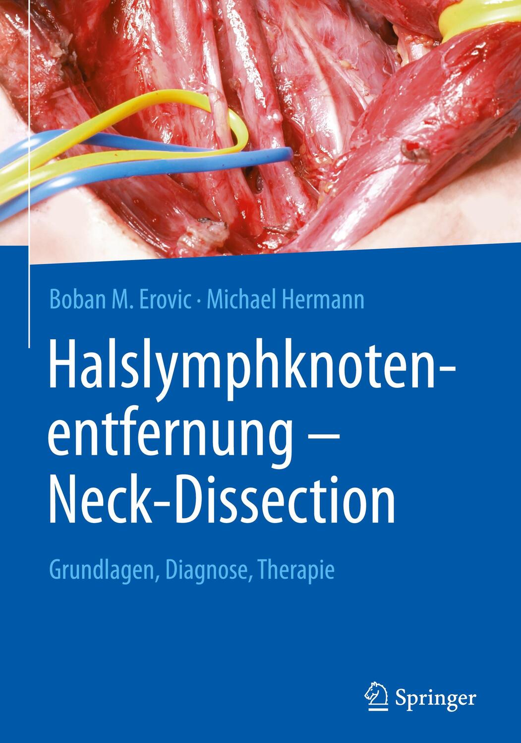 Cover: 9783662625651 | Halslymphknotenentfernung ¿ Neck-Dissection | Michael Hermann (u. a.)