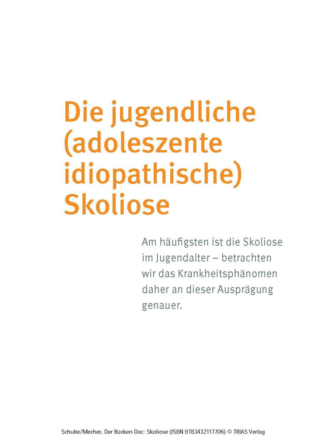 Bild: 9783432117706 | Der Rücken-Doc: Skoliose | Tobias L. Schulte (u. a.) | Taschenbuch