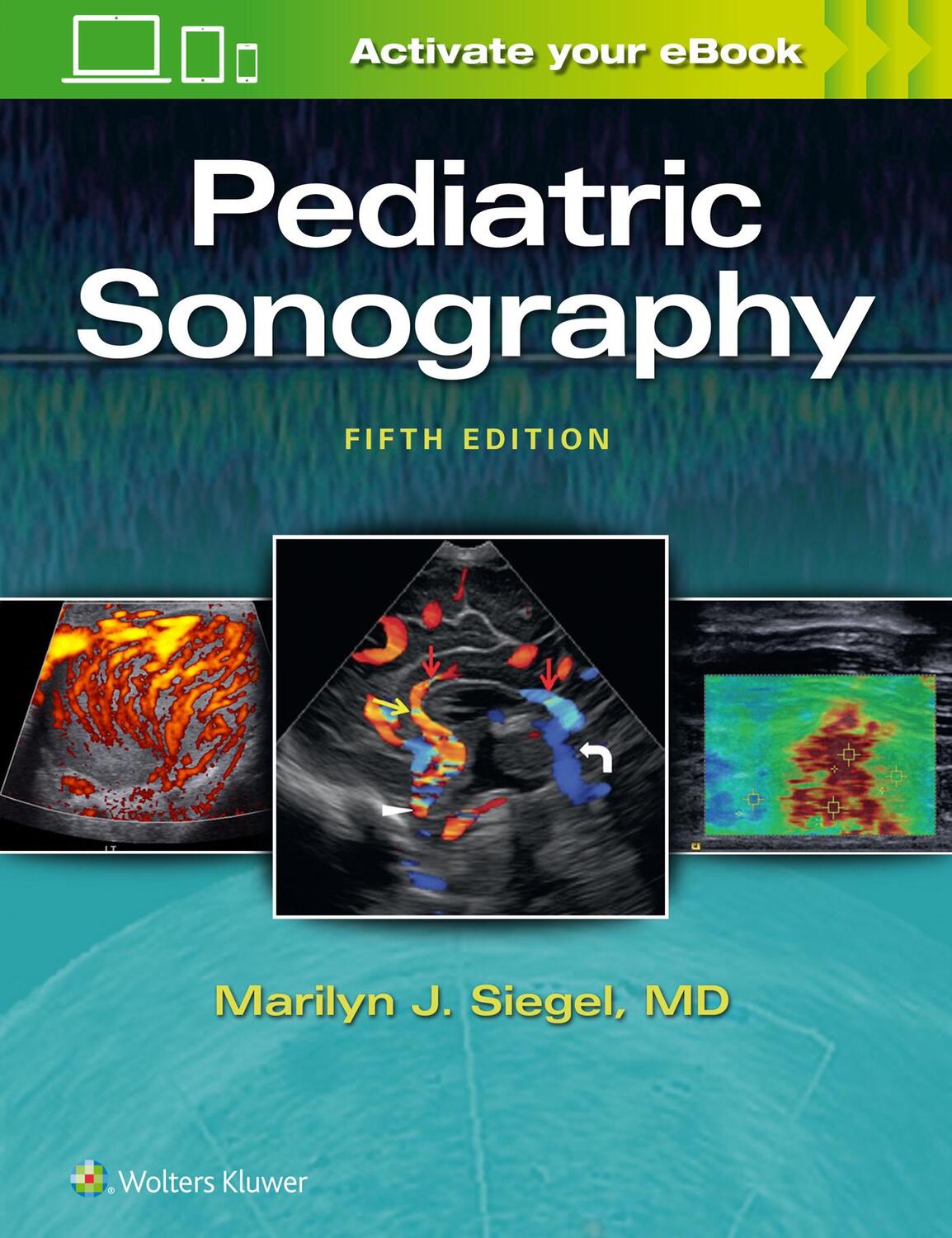 Cover: 9781496370563 | Pediatric Sonography | Marilyn J. Siegel | Buch | Englisch | 2018