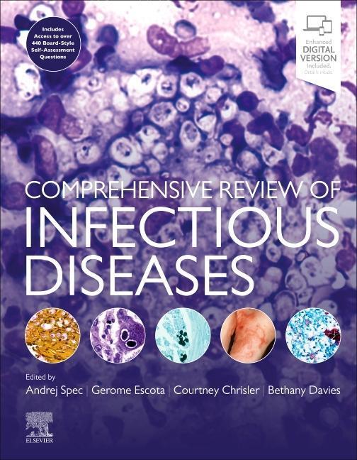 Cover: 9780323568661 | Comprehensive Review of Infectious Diseases | Andrej Spec (u. a.)