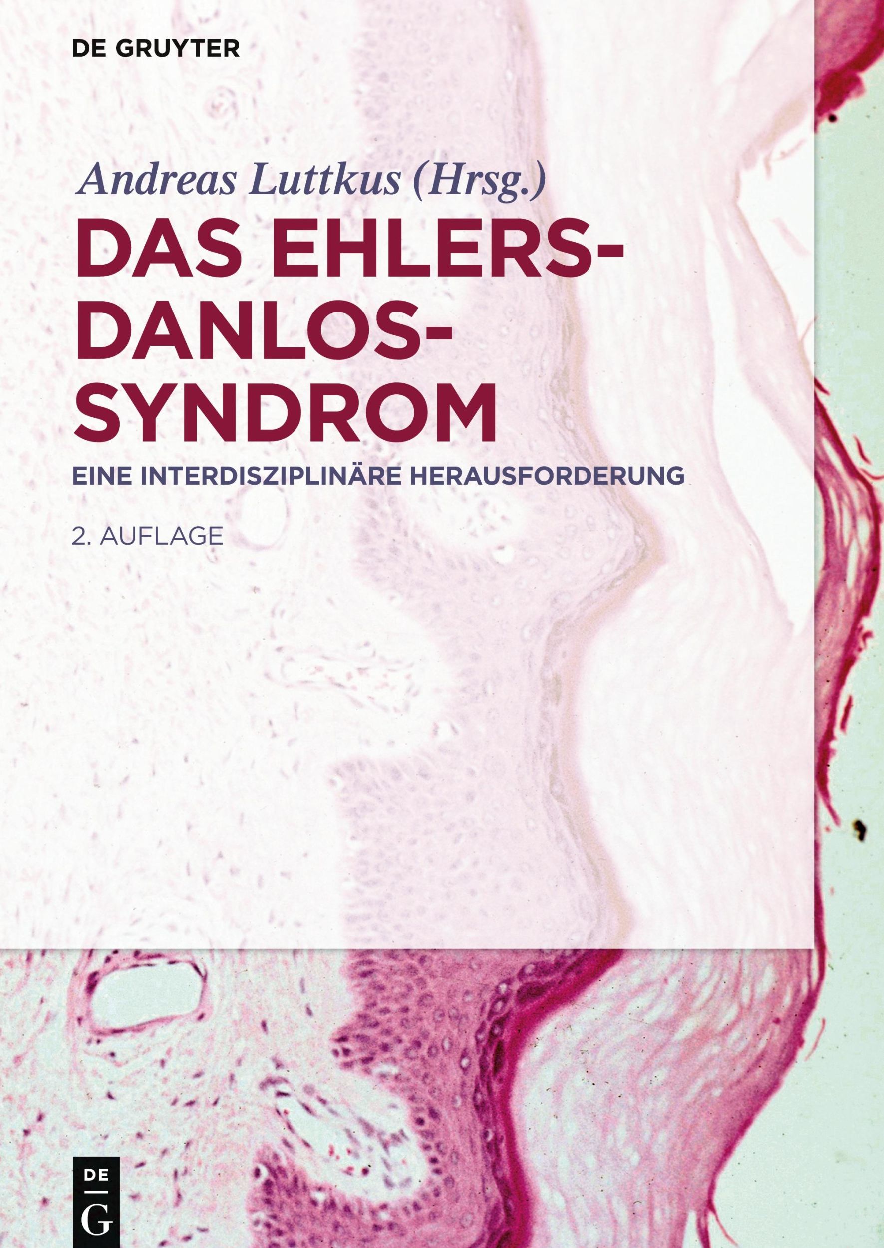 Cover: 9783110473643 | Das Ehlers-Danlos-Syndrom | Eine interdisziplinäre Herausforderung