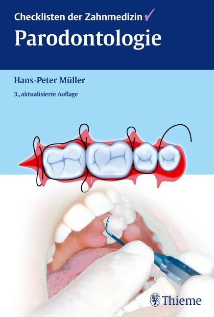 Cover: 9783131263636 | Checklisten der Zahnmedizin Parodontologie | Hans-Peter Müller | Buch