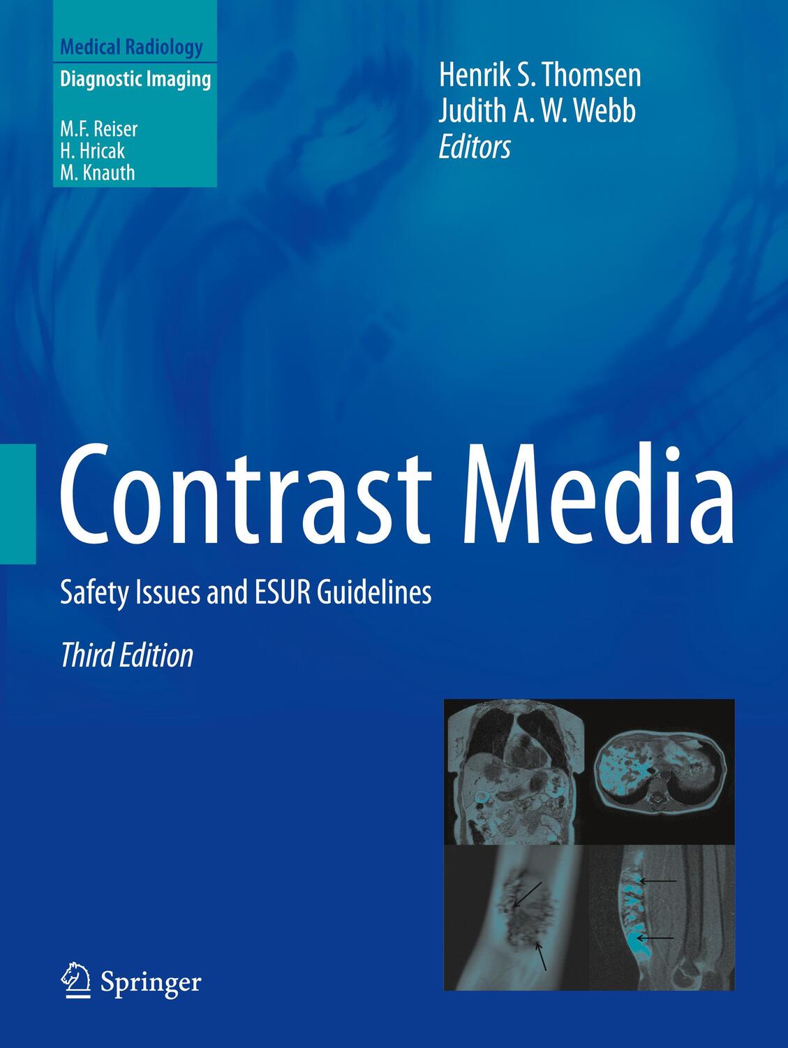 Cover: 9783662500064 | Contrast Media | Safety Issues and ESUR Guidelines | Webb (u. a.)