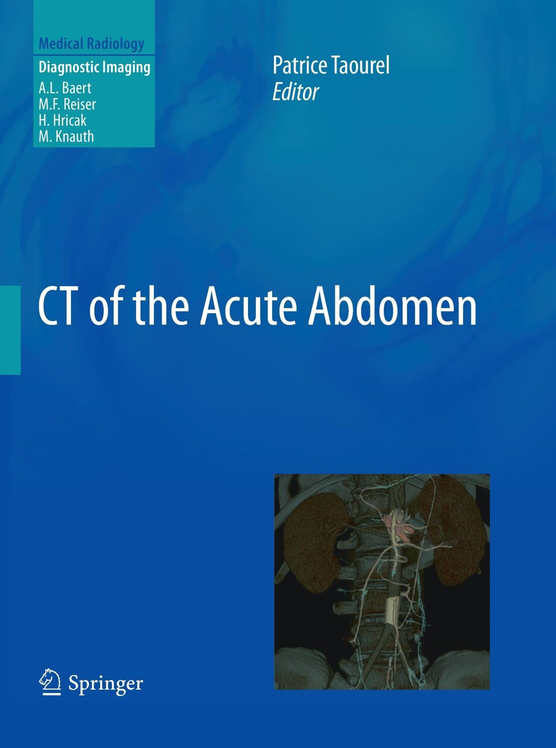 Cover: 9783662502341 | CT of the Acute Abdomen | Patrice Taourel | Taschenbuch | Paperback