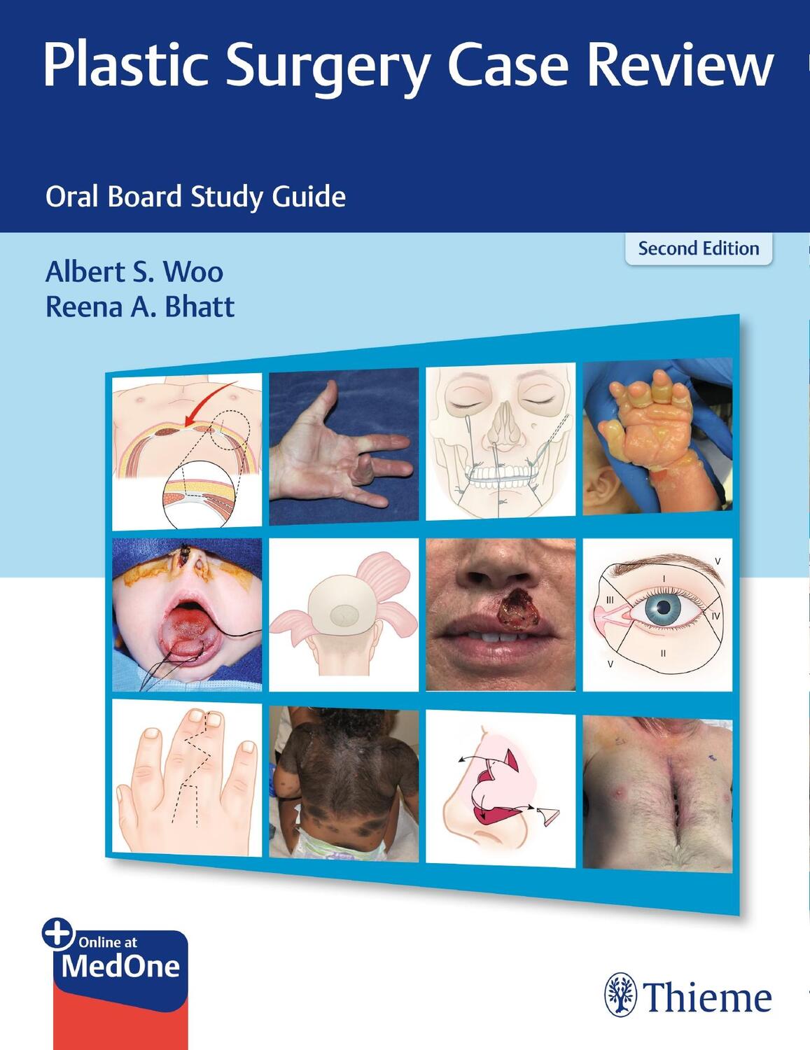 Cover: 9781684200627 | Plastic Surgery Case Review | Oral Board Study Guide | Woo (u. a.)