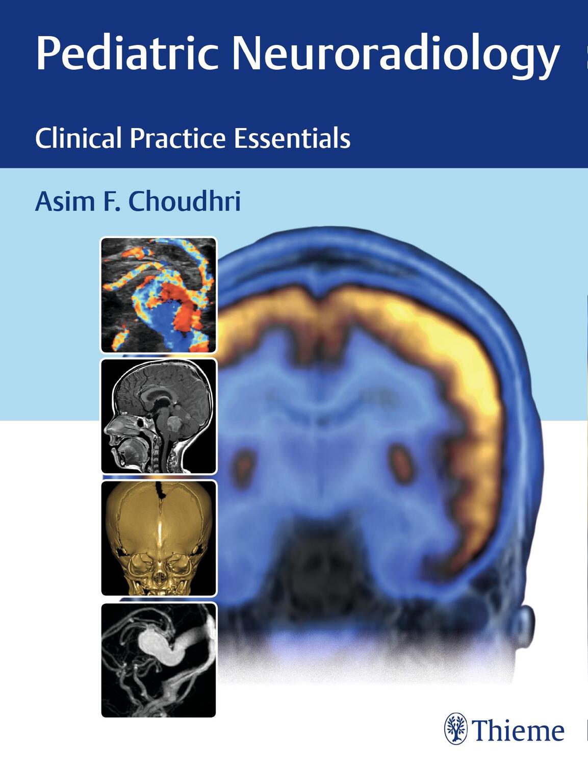 Cover: 9781626230965 | Pediatric Neuroradiology | Clinical Practice Essentials | Choudhri