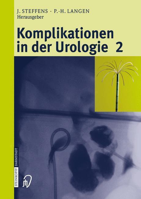 Bild: 9783798515437 | Komplikationen in der Urologie 2 | Band 2 | J. Steffens (u. a.) | Buch