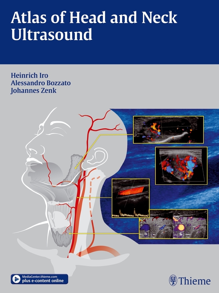 Cover: 9783131603517 | Atlas of Head and Neck Ultrasound | Heinrich Iro (u. a.) | Taschenbuch