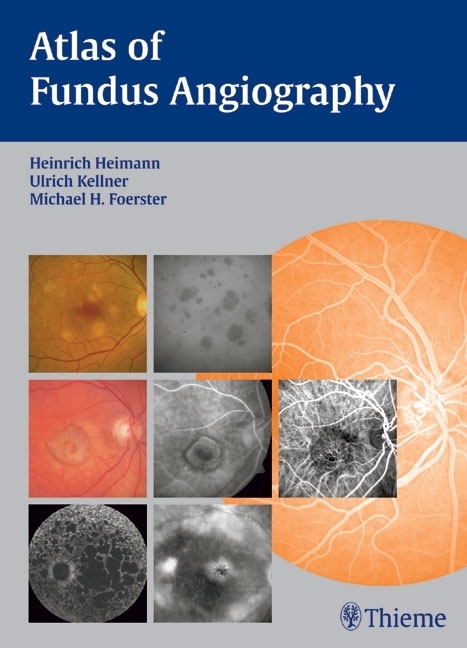 Cover: 9783131405517 | Atlas of Fundus Angiography | Heinrich Heimann (u. a.) | Buch | 192 S.