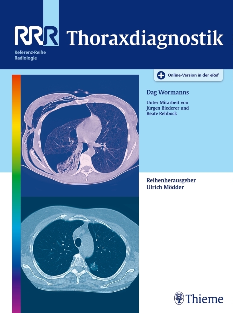 Cover: 9783131695918 | Thoraxdiagnostik | Mit Online-Version in der eRef | Dag Wormanns