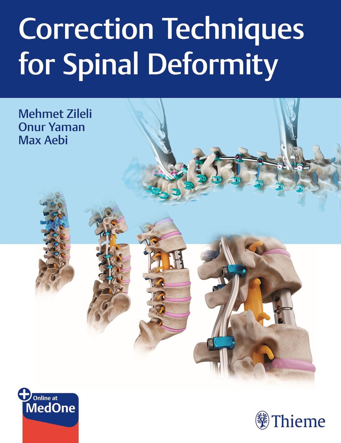 Cover: 9789395390101 | Correction Techniques for Spinal Deformity | Mehmet Zileli (u. a.)