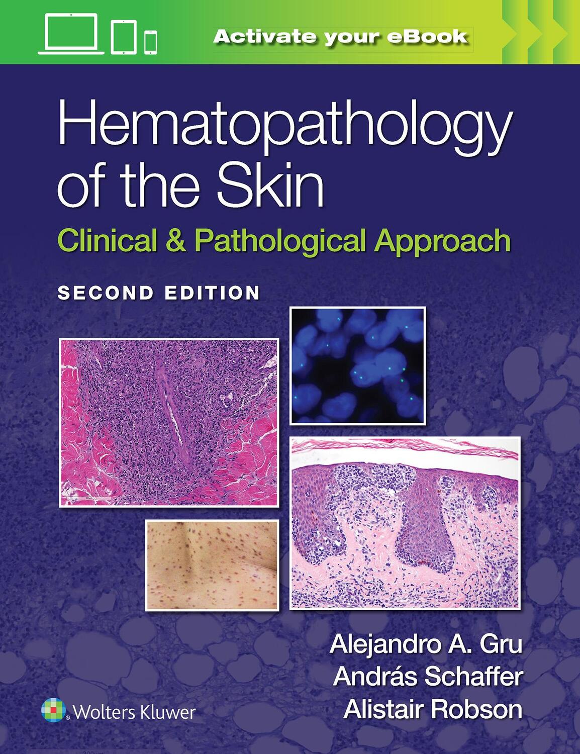 Cover: 9781975158552 | Hematopathology of the Skin | Clinical & Pathological Approach | Buch