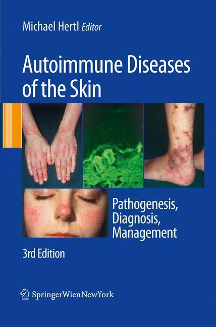 Cover: 9783211992241 | Autoimmune Diseases of the Skin | Pathogenesis, Diagnosis, Management