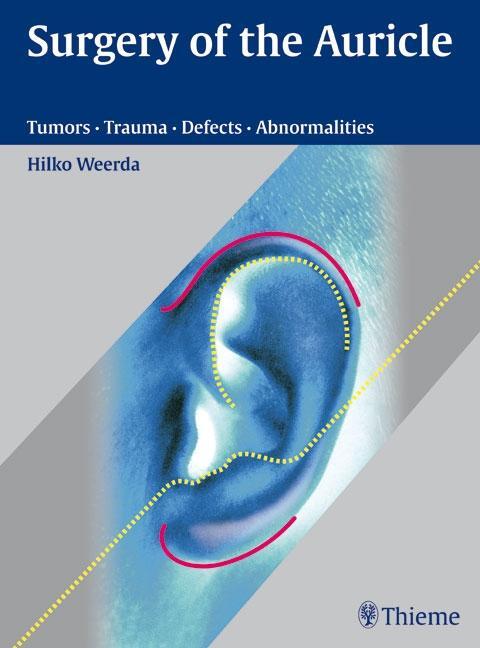 Cover: 9783131394118 | Surgery of the Auricle | Tumors - Trauma - Defects - Abnormalities