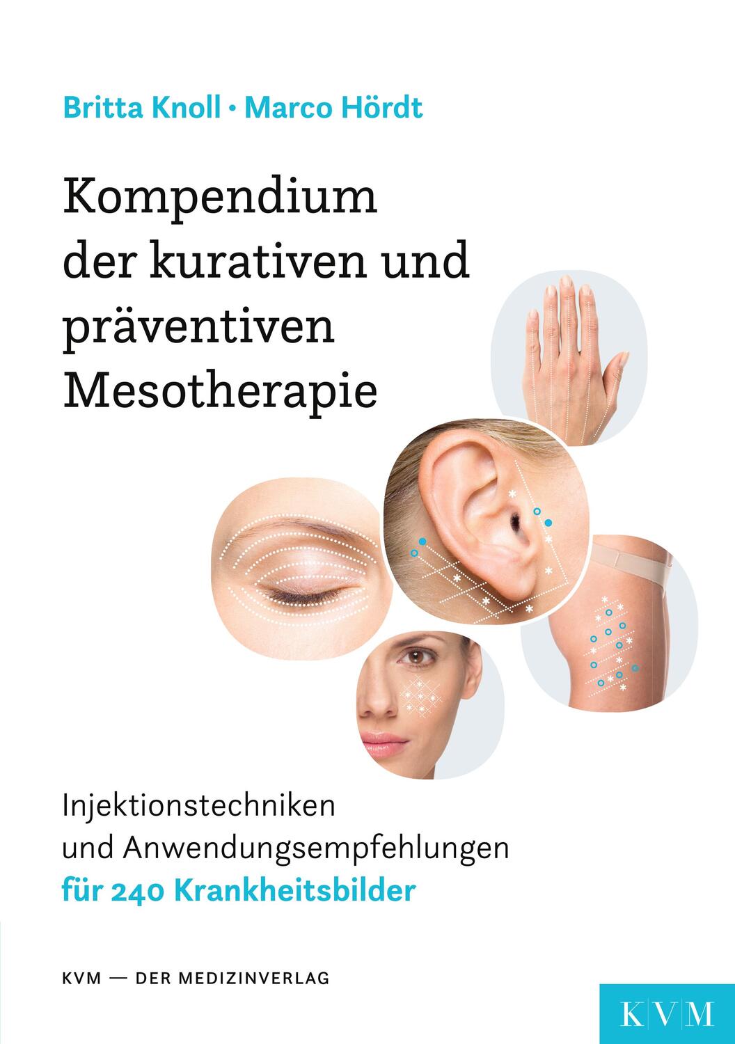 Cover: 9783868675153 | Kompendium der kurativen und präventiven Mesotherapie | Knoll (u. a.)