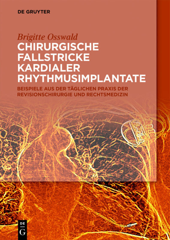 Cover: 9783110636963 | Chirurgische Fallstricke kardialer Rhythmusimplantate | Osswald | Buch