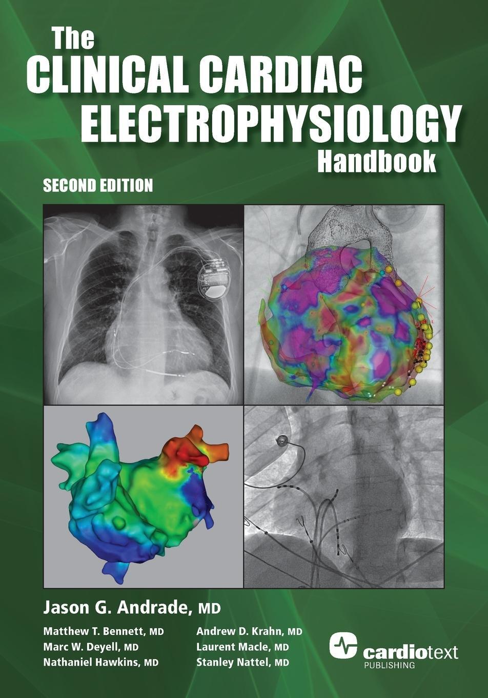 Cover: 9781942909347 | The Clinical Cardiac Electrophysiology Handbook, Second Edition | Buch