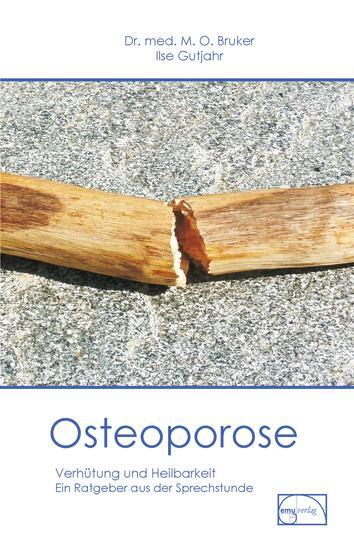 Cover: 9783891890387 | Osteoporose | Dichtung und Wahrheit | Max Otto Bruker | Taschenbuch
