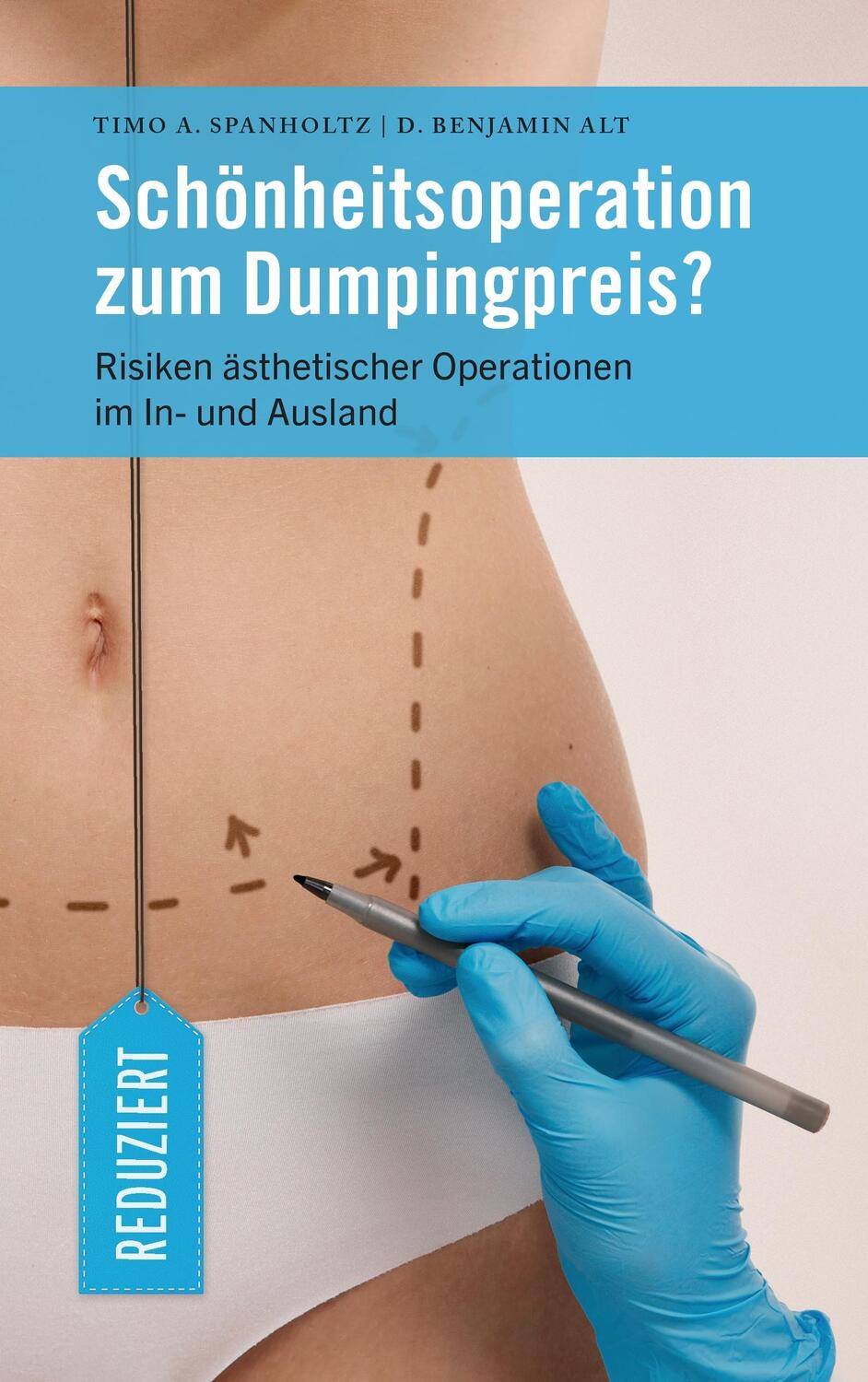 Cover: 9783741284472 | Schönheitsoperation zum Dumpingpreis? | D. Benjamin Alt (u. a.) | Buch