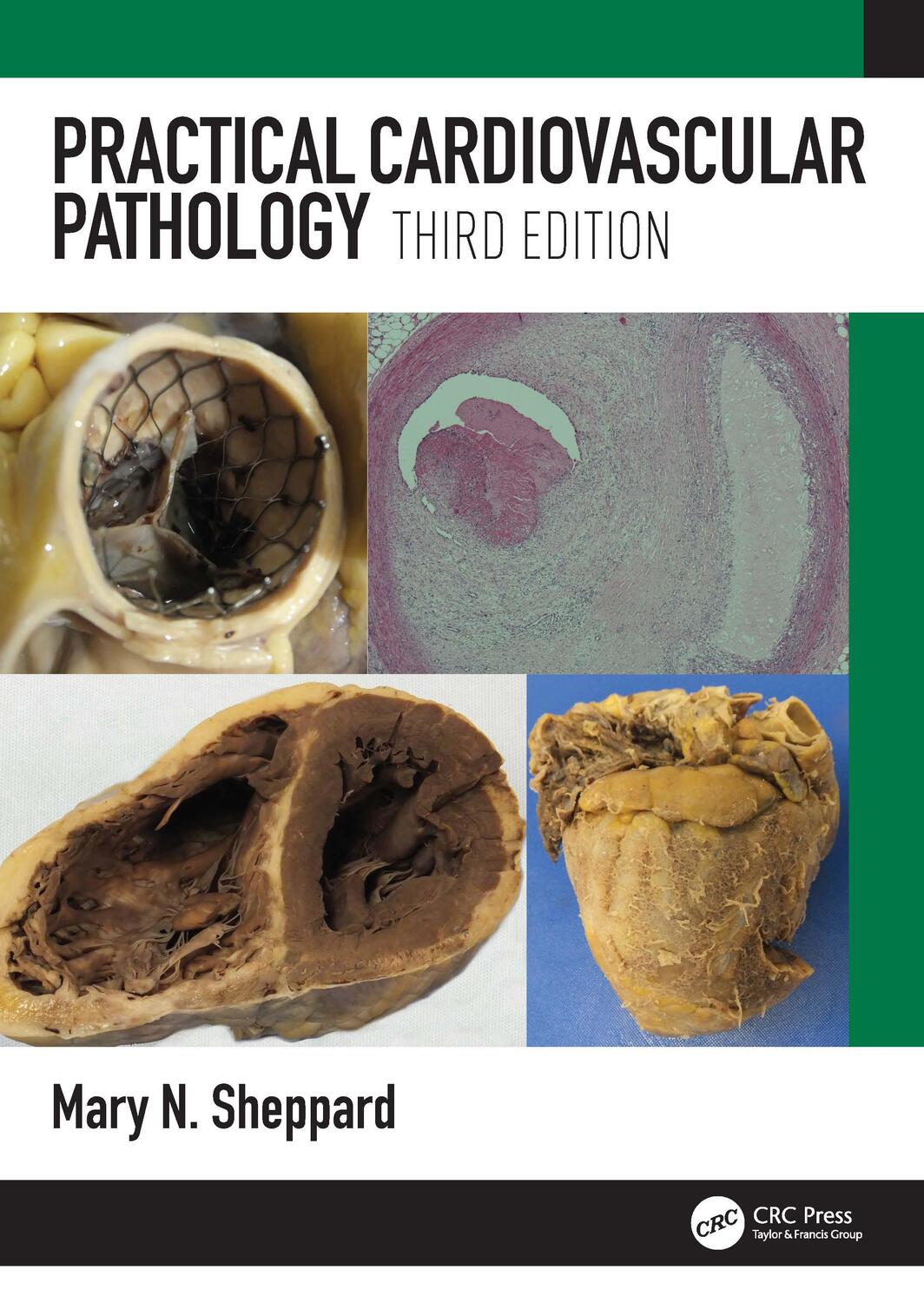 Cover: 9781498787550 | Practical Cardiovascular Pathology | Mary N. Sheppard | Buch | 2022