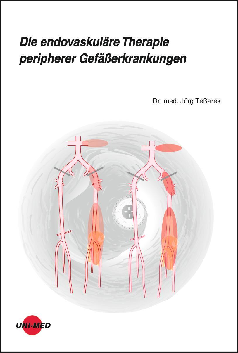 Cover: 9783837416343 | Die endovaskuläre Therapie peripherer Gefäßerkrankungen | Jörg Teßarek