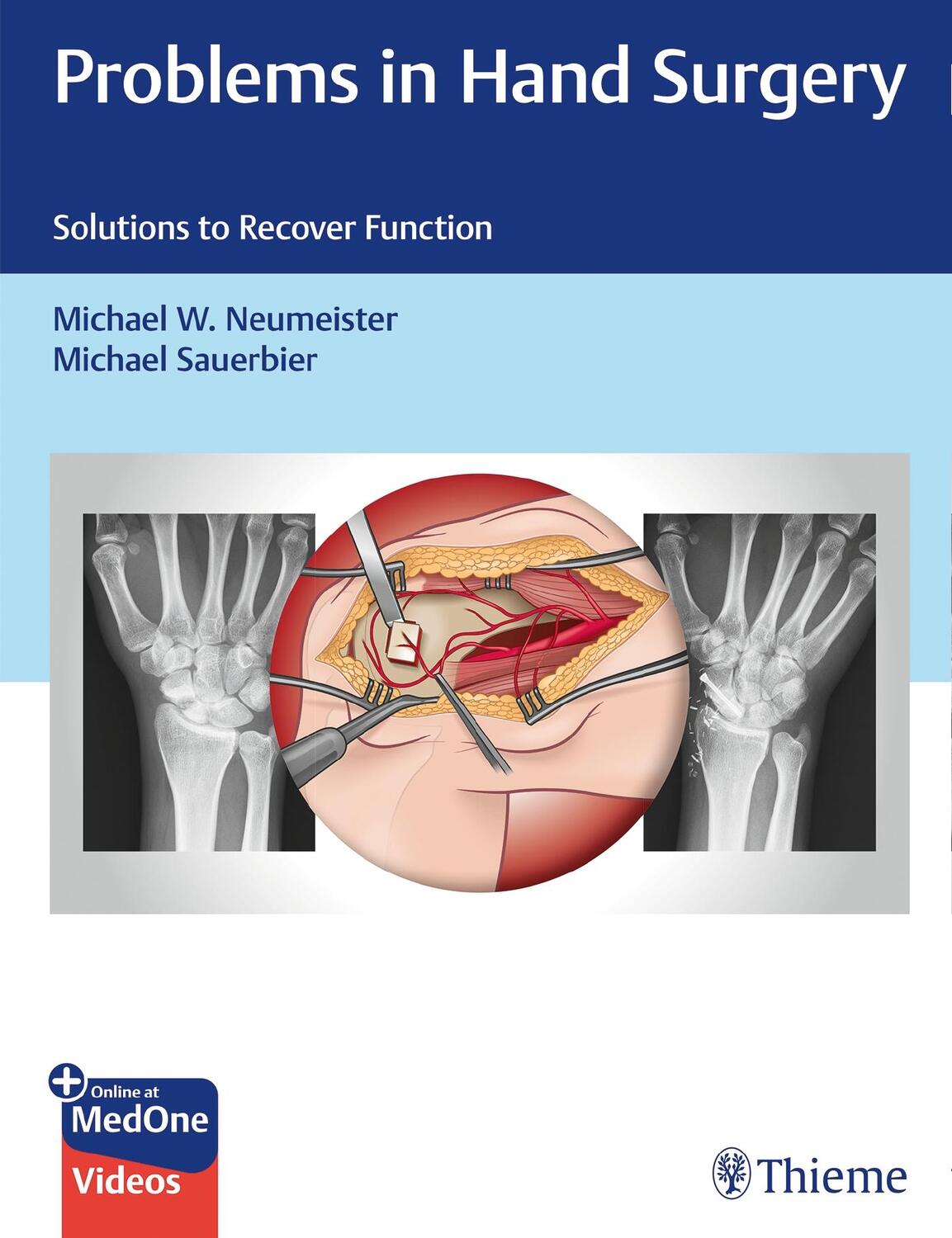 Cover: 9781626237094 | Problems in Hand Surgery: Solutions to Recover Function | Buch | 2020