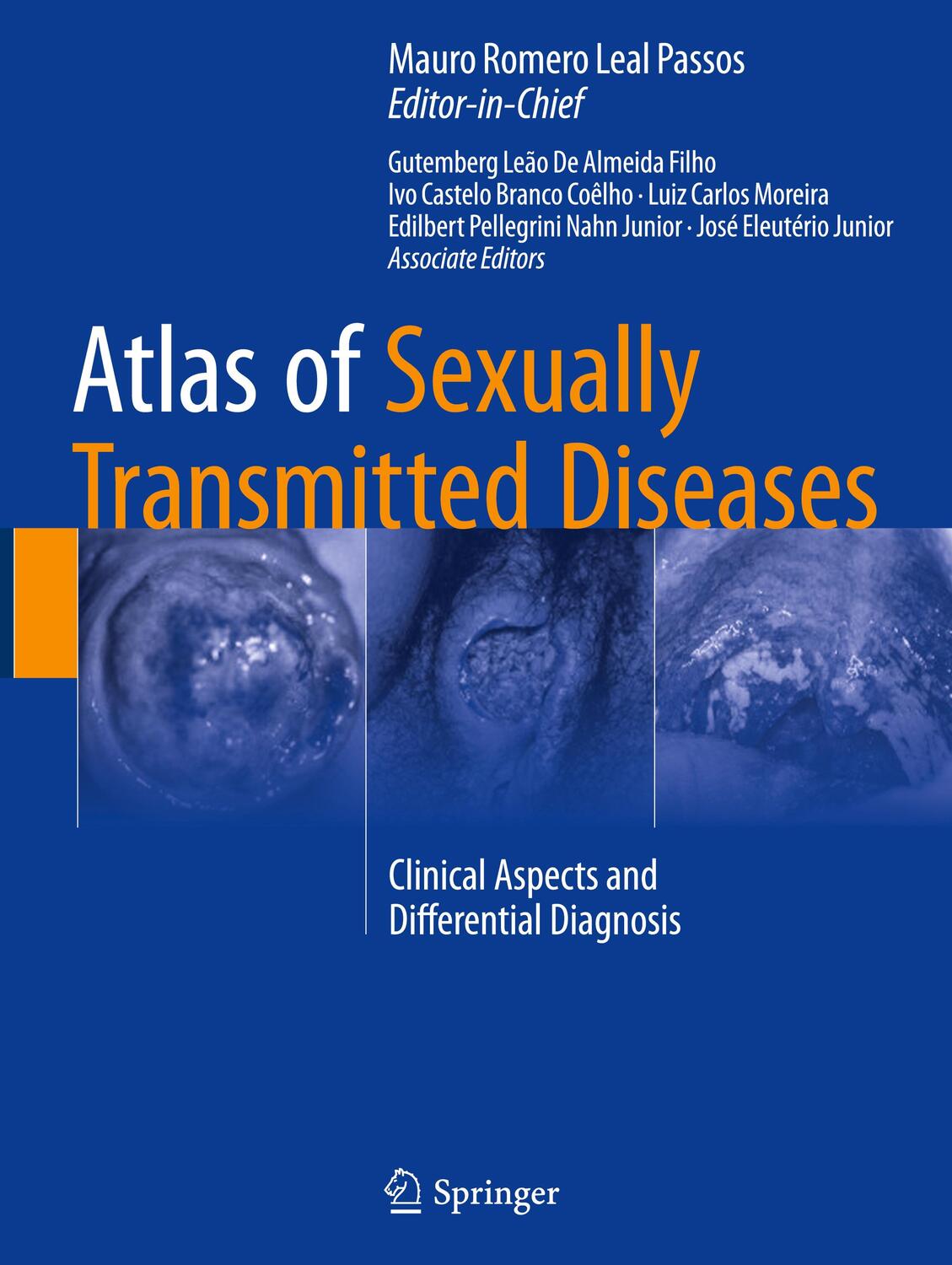 Cover: 9783319574684 | Atlas of Sexually Transmitted Diseases | Mauro Romero Leal Passos