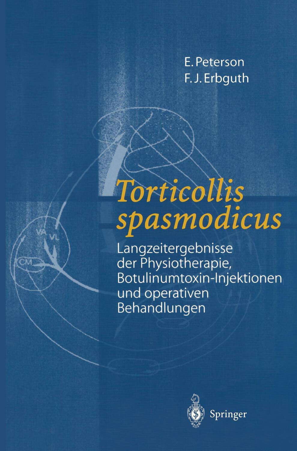 Cover: 9783540674481 | Torticollis spasmodicus | E. Peterson (u. a.) | Taschenbuch | Springer