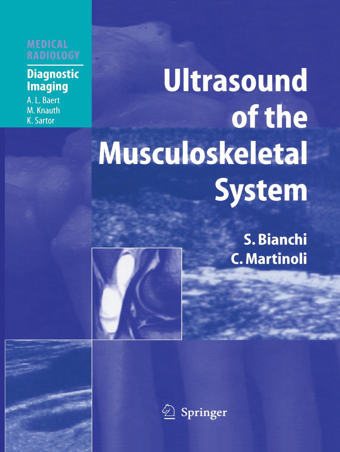 Cover: 9783662499641 | Ultrasound of the Musculoskeletal System | Carlo Martinoli (u. a.)