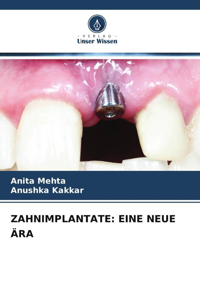 Cover: 9786205453087 | ZAHNIMPLANTATE: EINE NEUE ÄRA | Anita Mehta (u. a.) | Taschenbuch