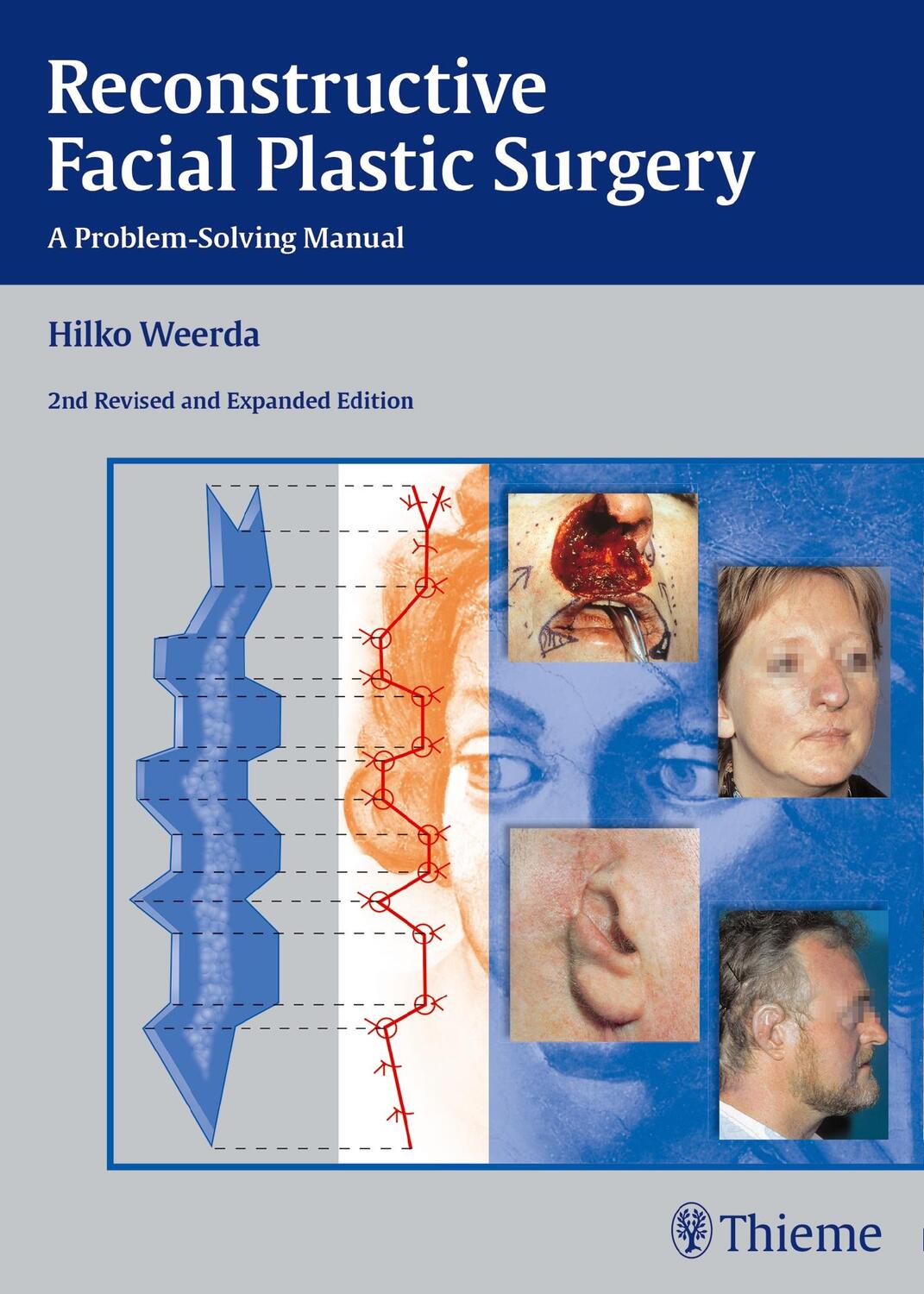 Cover: 9783131296429 | Reconstructive Facial Plastic Surgery | A Problem-Solving Manual