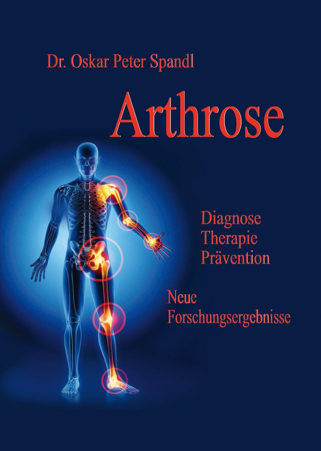 Cover: 9783948397364 | Arthrose | Diganose, Therapie, Prävention - neue Forschungsergebnisse