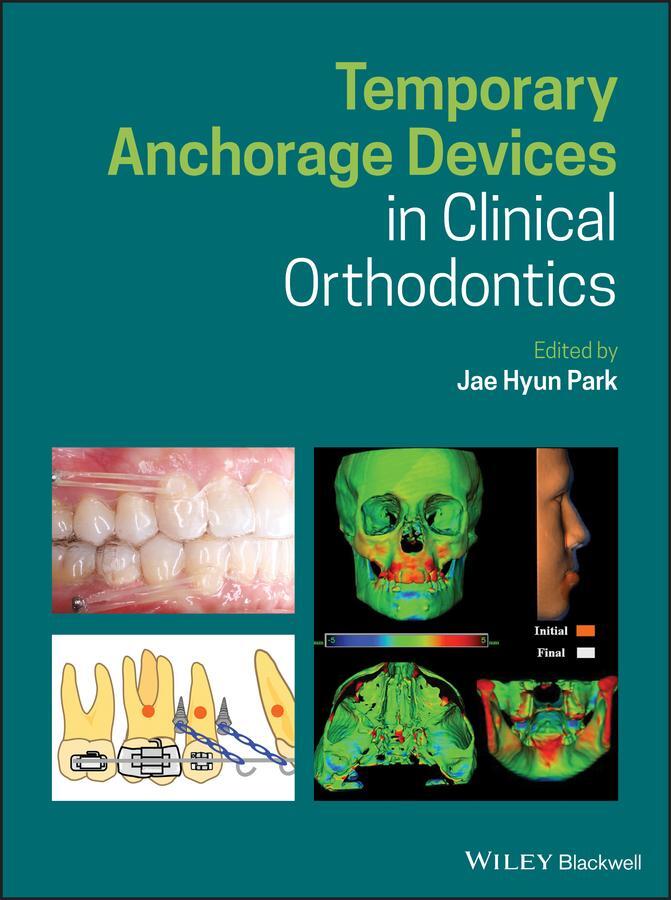 Cover: 9781119513476 | Temporary Anchorage Devices in Clinical Orthodontics | Jae Hyun Park
