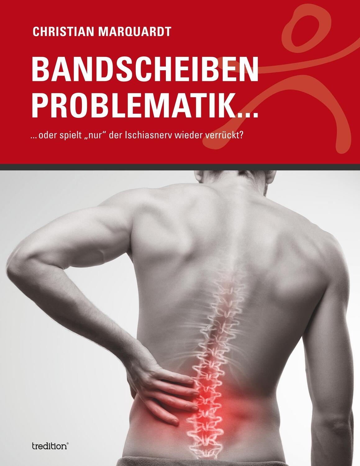 Cover: 9783748243199 | Bandscheiben Problematik | Christian Marquardt | Taschenbuch