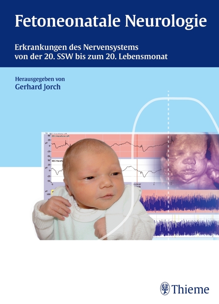 Cover: 9783131653116 | Fetoneonatale Neurologie | Gerhard Jorch | Buch | 384 S. | Deutsch