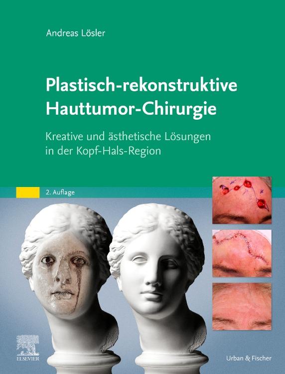 Cover: 9783437212543 | Plastisch-rekonstruktive Hauttumor-Chirurgie | Andreas Lösler | Buch