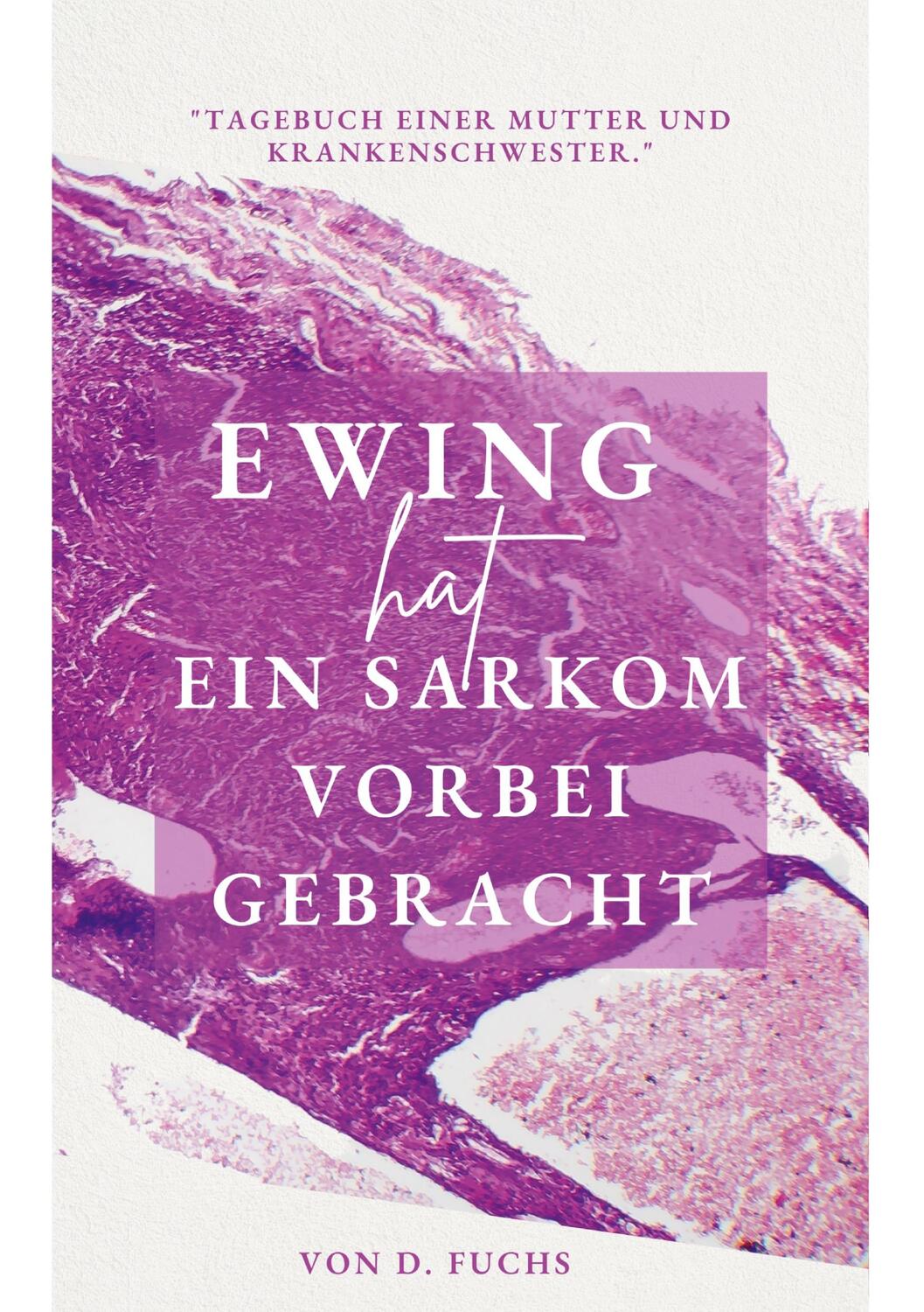 Cover: 9783757802813 | Ewing hat ein Sarkom vorbeigebracht | D. Fuchs | Taschenbuch | Deutsch