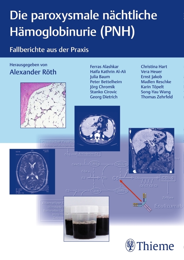 Cover: 9783131715616 | Die paroxysmale nächtliche Hämoglobinurie (PNH) | Alexander Röth