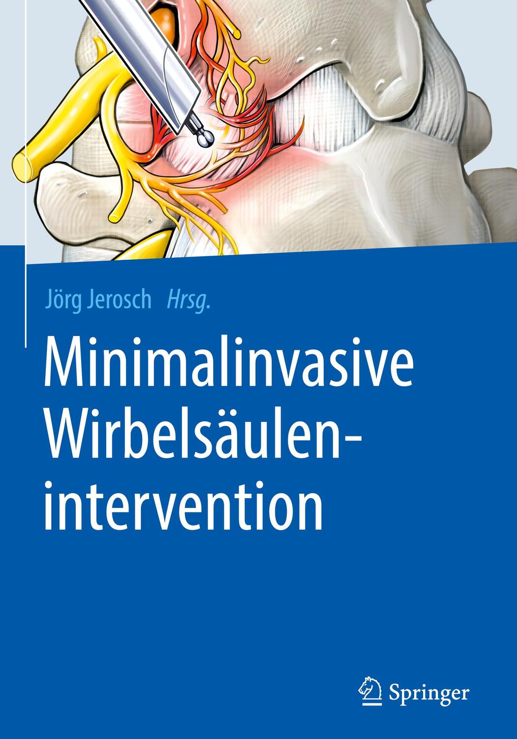 Cover: 9783662580936 | Minimalinvasive Wirbelsäulenintervention | Jörg Jerosch | Buch | 2019