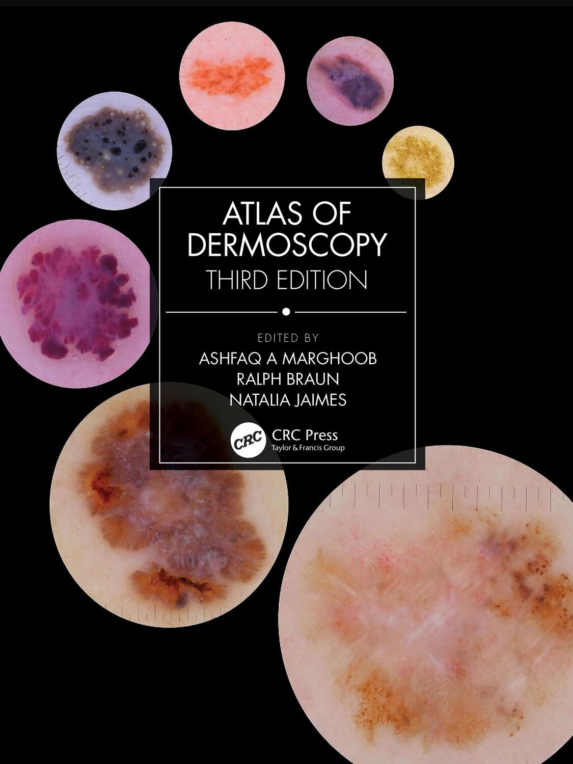 Cover: 9781138595989 | Atlas of Dermoscopy | Third Edition | Ashfaq A Marghoob (u. a.) | Buch