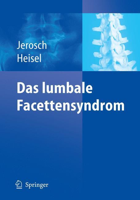 Cover: 9783540277095 | Das lumbale Facettensyndrom | Jörg Jerosch (u. a.) | Taschenbuch