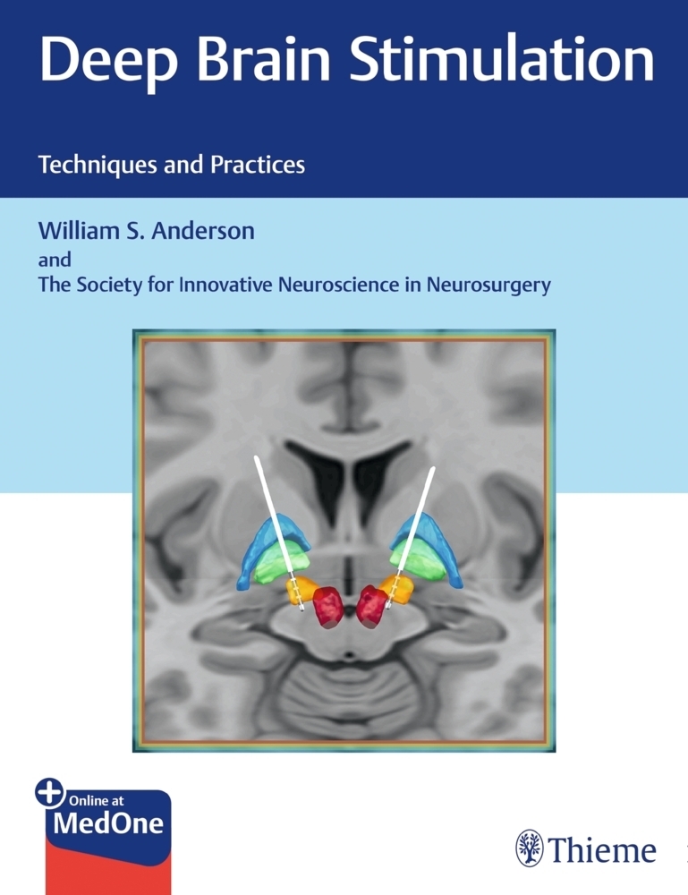 Cover: 9781626237971 | Deep Brain Stimulation | William S. Anderson (u. a.) | Bundle | 2019