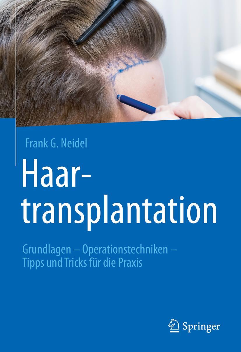 Cover: 9783662648520 | Haartransplantation | Frank G. Neidel | Buch | x | Deutsch | 2022